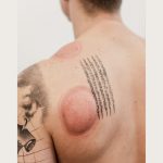 Aerify Cupper with Red Light Therapy Cupping s crvenim svjetlom5